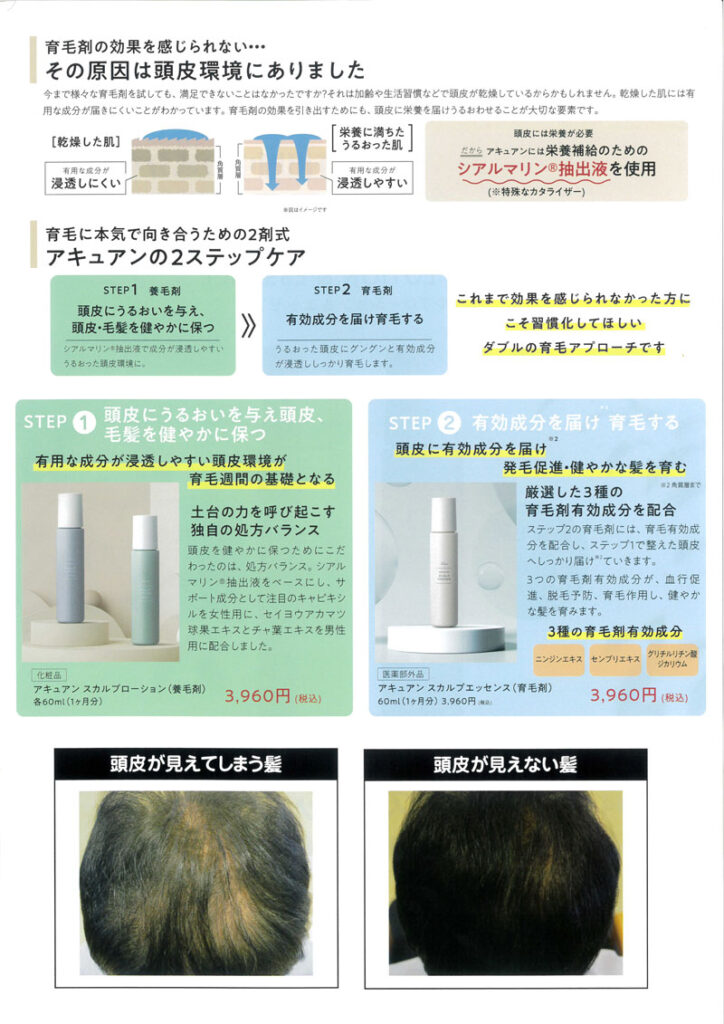 その原因は頭皮環境にありました